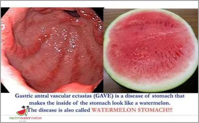 This One Fruit Could Solve All Your Stomach Problems - Find Out Now!